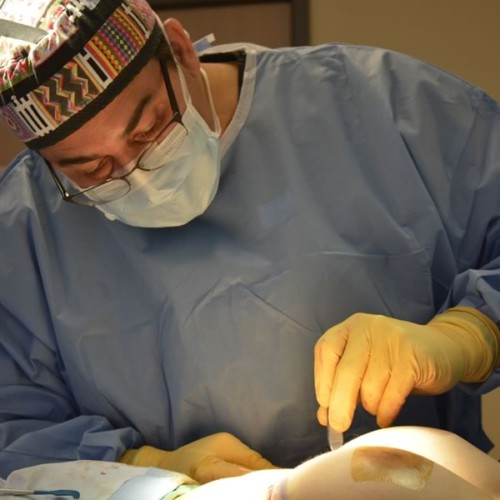 Breast Procedure by Dr. Max Polo, plastic surgeon