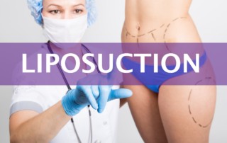 Liposuction vs Tummy Tuck