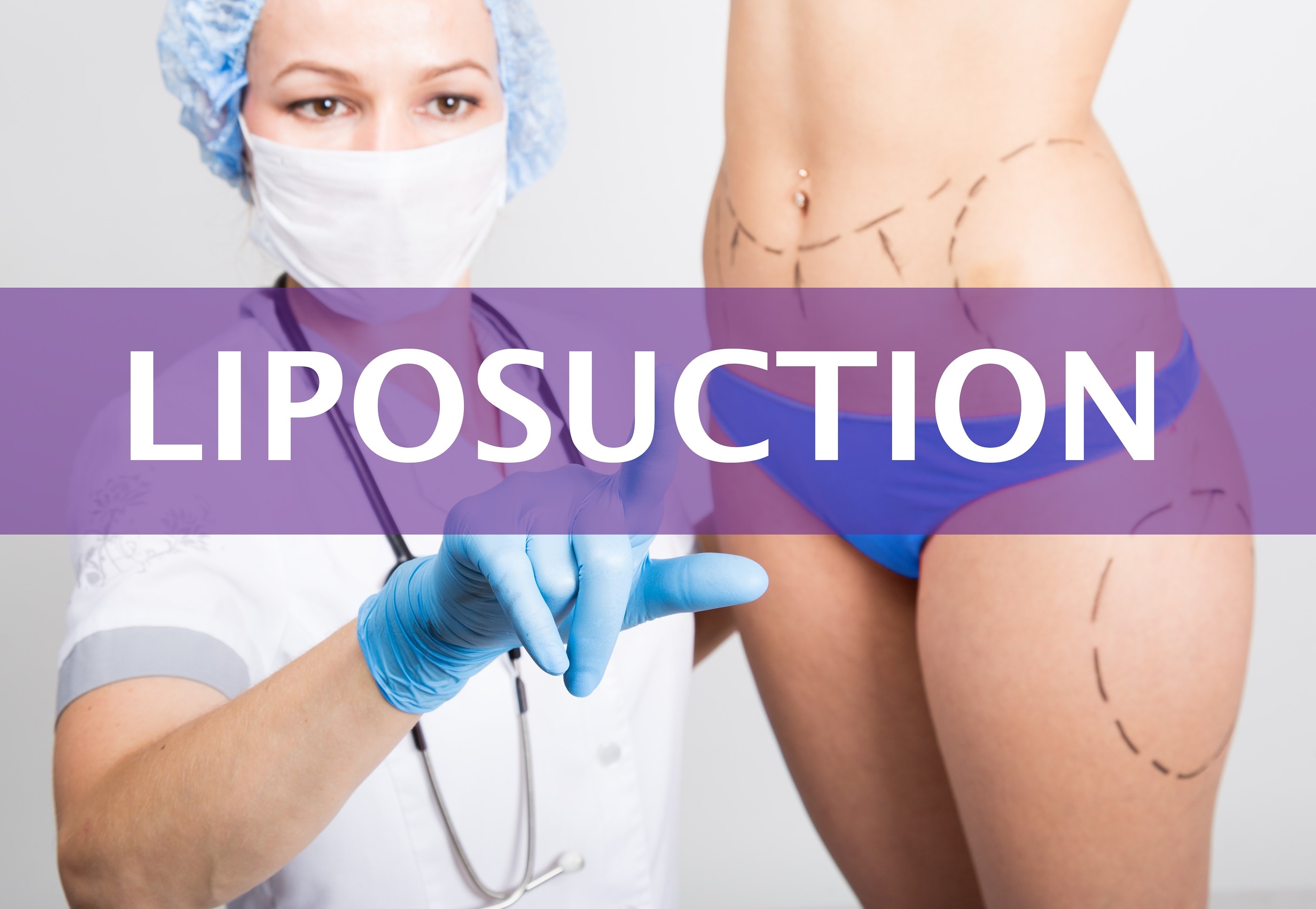 Dr. Trussler Liposuction Surgery Austin