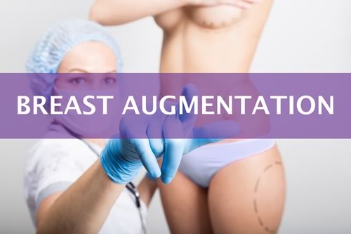 Breast Augmentation - Dr. Max Polo