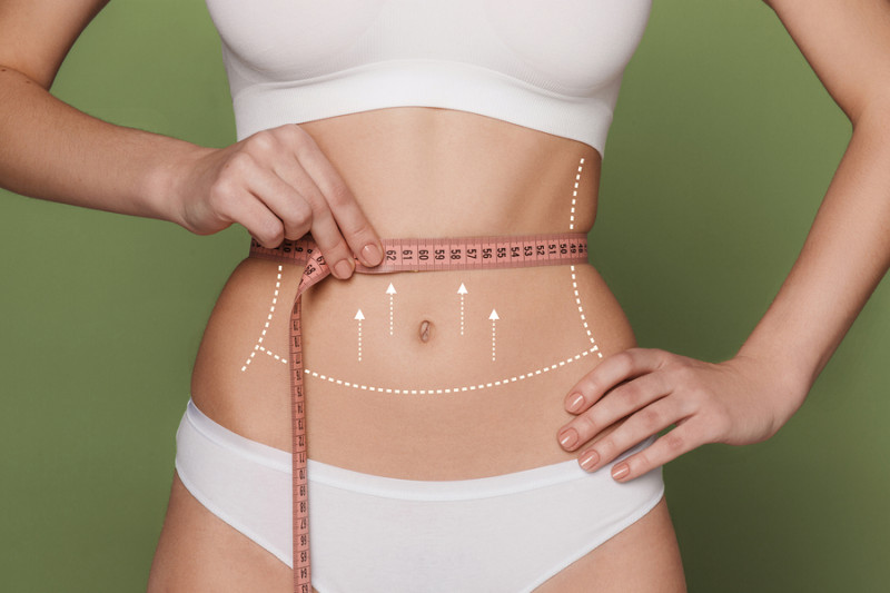 tummy tuck