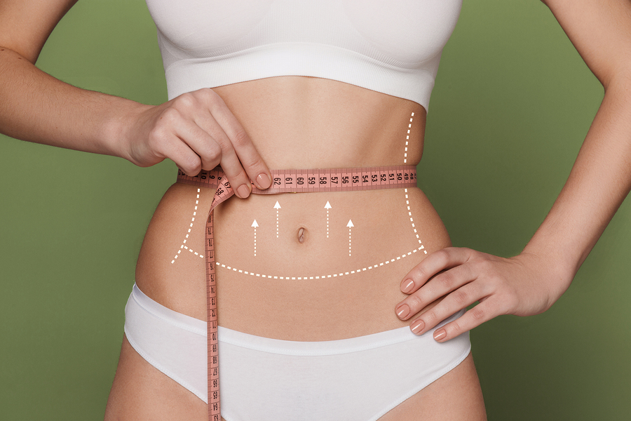 Tummy Tuck Surgery Miami  Tummy Tuck Recovery - Dr. Max Polo